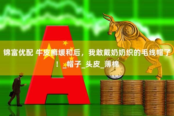 锦富优配 牛皮癣缓和后，我敢戴奶奶织的毛线帽了！_帽子_头皮_薄棉